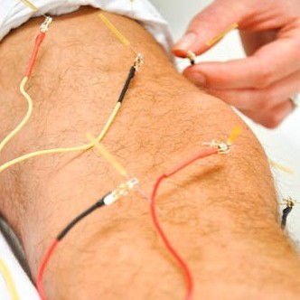 TENS (Transkutane Elektrische Nervenstimulation)